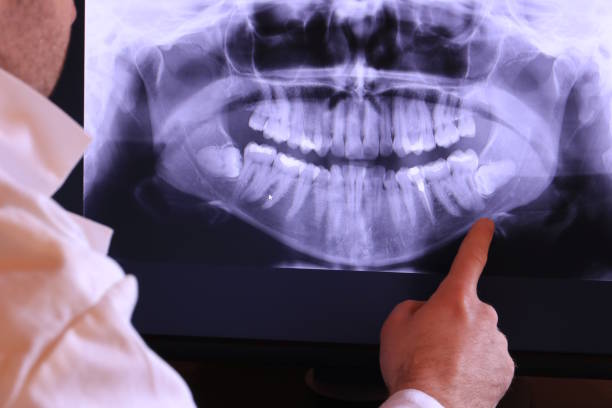 Best Pediatric Emergency Dentist in Harrogate, TN