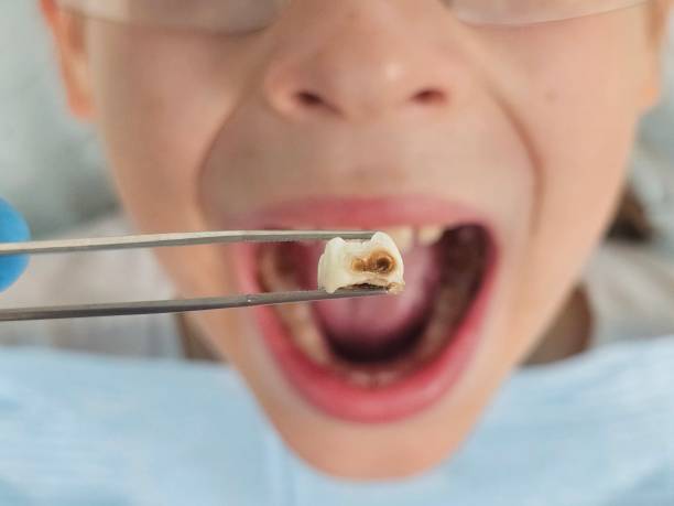 Best Emergency Denture Repair in Harrogate, TN