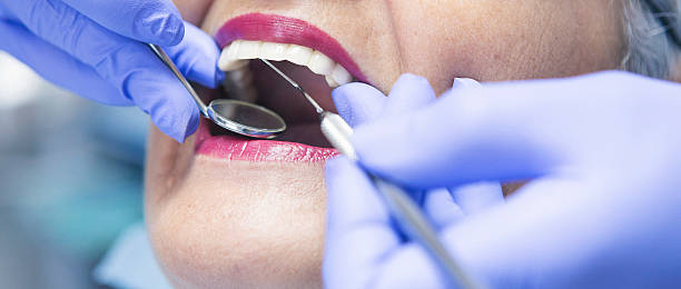 Best Emergency Tooth Extraction in Harrogate, TN